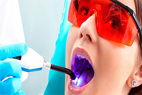 Diode Laser Used in Orthodontics